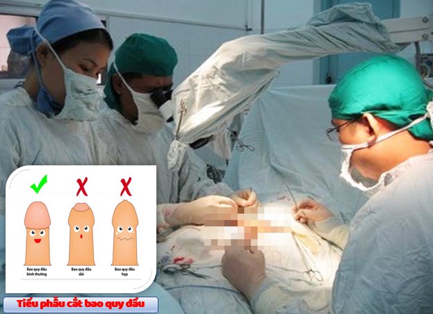 Tiểu phẫu cắt bao quy đầu tại Hà Nội